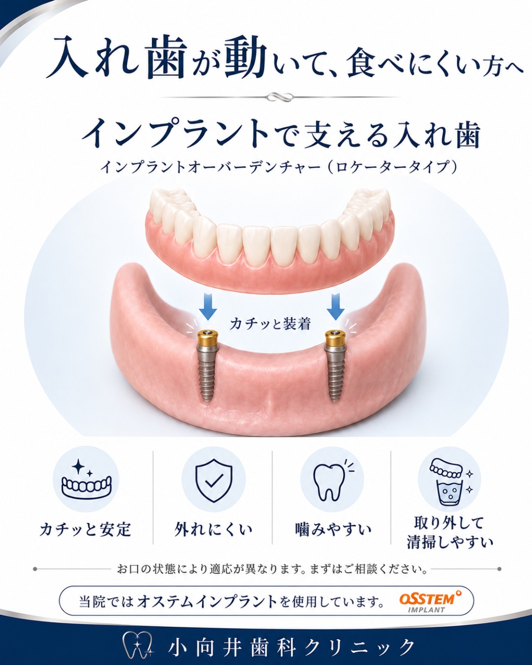 入れ歯が動いて、