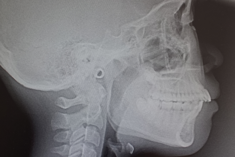 高精度シミュレーション